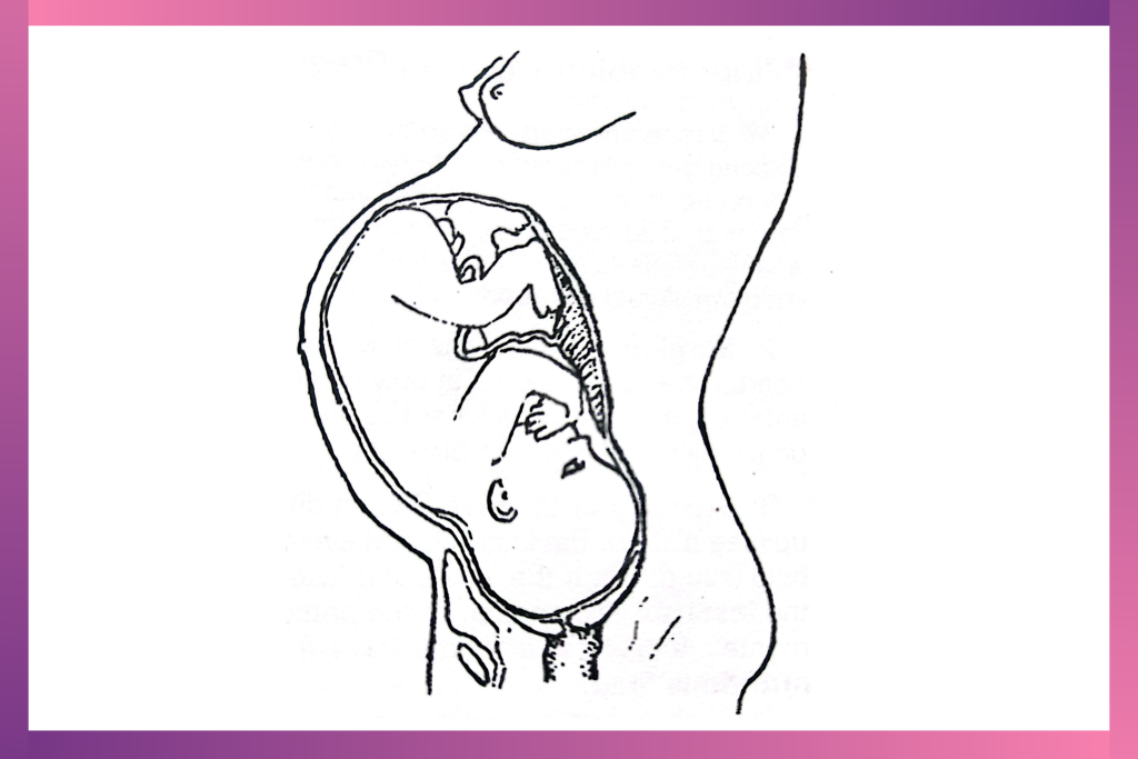 Image showing the normal position of the baby in the mother at 9 months