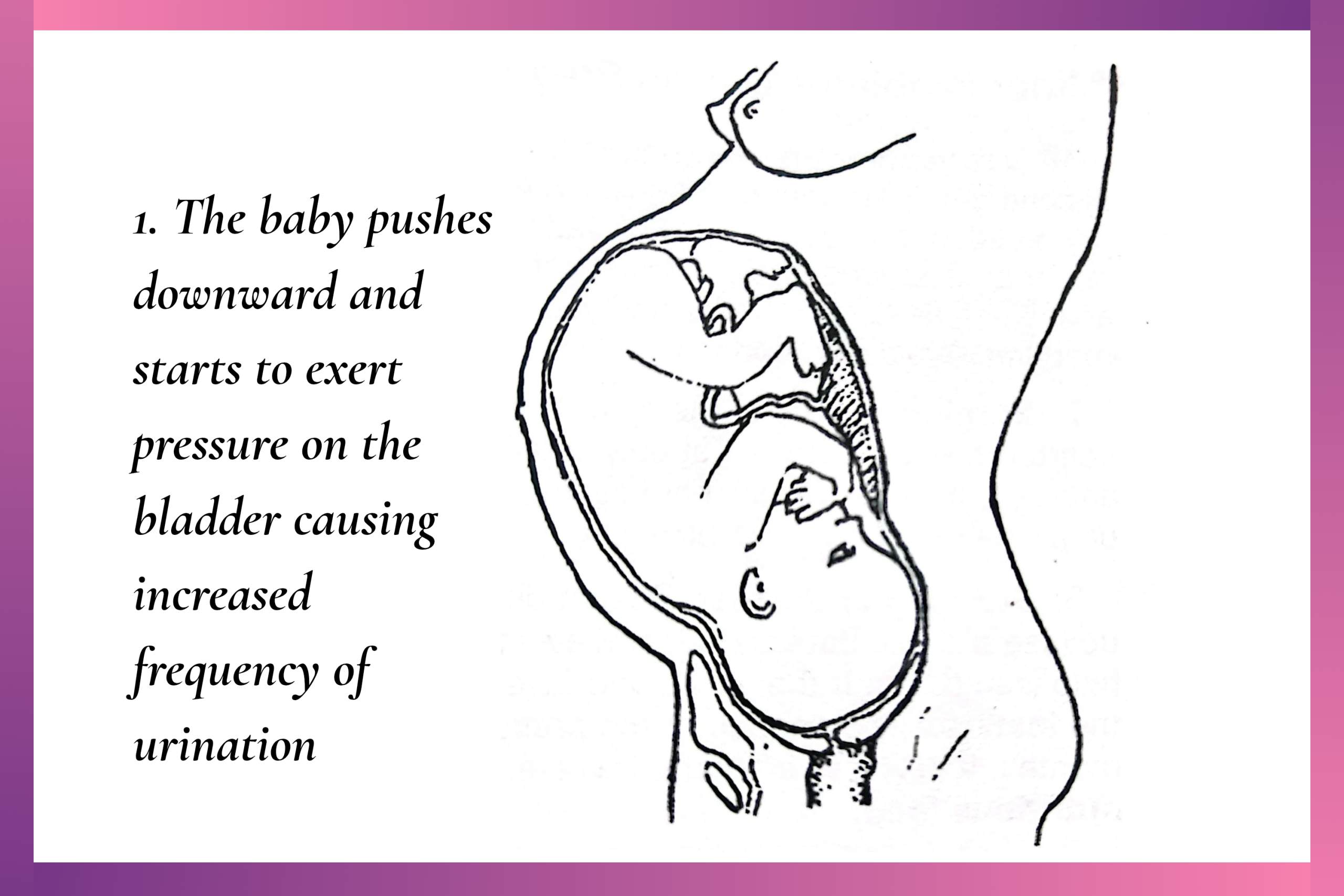 Image showing one of the signs that labour is coming soon (how to know that labor is near)