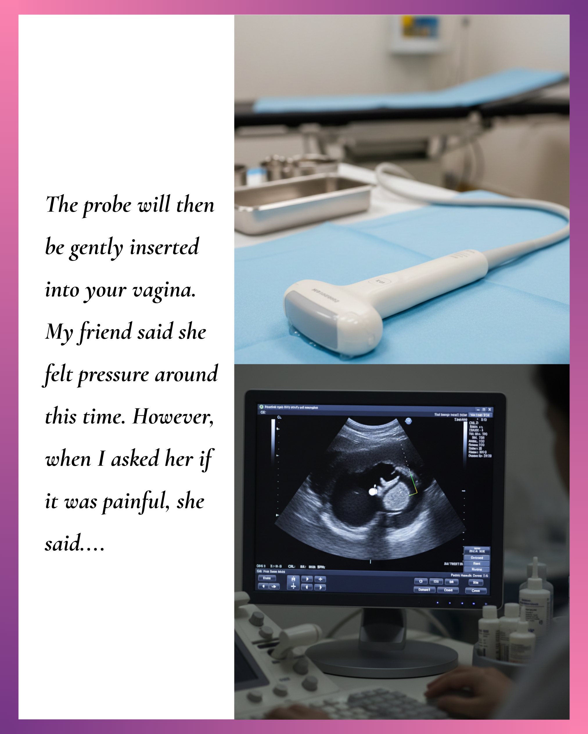 An image noting one of the steps to 4 weeks pregnant ultrasound
